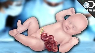 Why Some Babies Are Born With Organs On The Outside [upl. by Heidy]