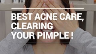 The Best ACNE Care Tips for Clearing Pimple with Eunices naked face XD  Wishtrend [upl. by Aronid]