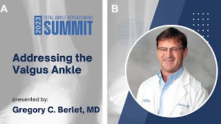 Addressing the Valgus Ankle  Gregory C Berlet MD [upl. by Truman]