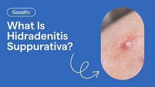 Hidradenitis Suppurativa Explained Symptoms Causes and Complications  GoodRx [upl. by Ahtiekahs]