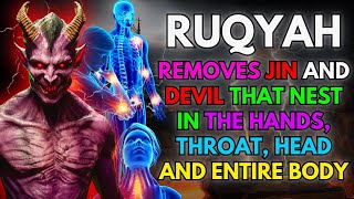 MIRACLE RUQYAH REMOVES JINN AND DEVIL THAT NEST IN THE HANDS HEAD TROATH AND ENTIRE BODY [upl. by Nomrej]