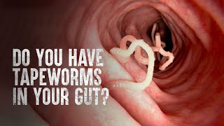 How to Survive Tapeworms Warning distressing footage [upl. by Airetahs]