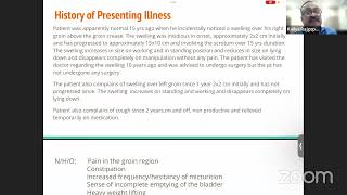 Inguinal Hernia case presentation [upl. by Cliff454]