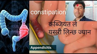 Appendicitis Causesigns symptoms and treatment [upl. by Obed315]