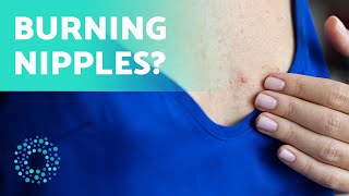 NIPPLE DERMATITIS 🔥 Treating Nipple Dermatitis at Home [upl. by Hnao]