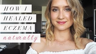 How I Healed Eczema Naturally  My Story [upl. by Enelrad]