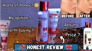 how to use eventone c face cream  even tone 4 face wash [upl. by Cyril558]