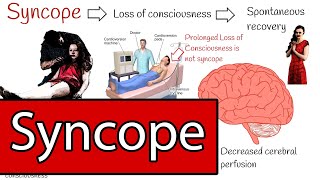 Syncope and Fainting Syncope Types and Treatment Simply explained [upl. by Julee]