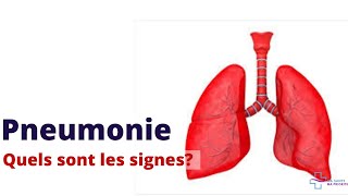 PNEUMONIE QUELS SONT LES SYMPTÔMES D´ALERTE [upl. by Aksoyn992]