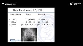 Acetabular deformity following slipped capital femoral epiphysis  Michael Millis Session 7 [upl. by Nogaem101]