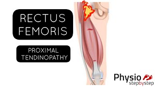 Rectus femoris TENDINOPATHY Reverse Nordic Curl progression [upl. by Enitsuga445]