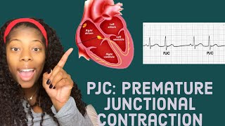 Basic EKG Identifying premature junctional contractions PJCS [upl. by Nwonknu]