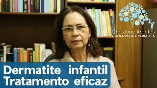 Eczema infantil  Tratamento [upl. by Certie105]