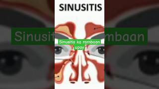 How to get rid of sinusitis sinusitis allergicrhinitis allergy ytshorts health pranyam yoga [upl. by Gora]