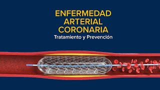 Enfermedad Arterial Coronaria EAC Tratamiento y prevención [upl. by Clyve201]