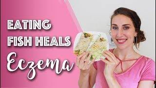 What I Eat in A Day for Eczema Relief Pescatarian  Paleo  Michelle Mills [upl. by Malik]