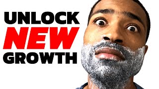 Key To Healthy New Beard Growth  Week 2 Black Mens Beard [upl. by Bratton904]