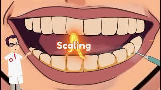 dental scaling and polishing  ASMR  dentist asmr  asmr dentist cleans your teeth [upl. by Nytsirt]