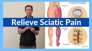 How to Relieve Sciatic Nerve Pain [upl. by Deerc]