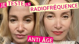 JE TESTE LA RADIOFRÉQUENCE ANTI ÂGE [upl. by Pebrook]