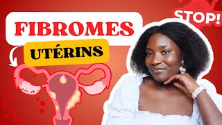 FIBROMES UTÉRINS  UN PROBLÈME MAJEUR POUR LES FEMMES NOIRES CE QUE VOUS DEVEZ SAVOIR [upl. by Lehpar]