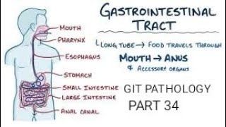 Intestine  Familial adenomatous polyposis git pathology intestines colon [upl. by Banebrudge]