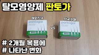 탈모영양제 판토가 2개월 복용 솔직후기ㅣ해외직구제품과 차이점ㅣ쉐딩현상 효과 부작용 탈모량 모발굵기 힘ㅣ탈모예방 탈모극복 탈모르파티 맥주효모 [upl. by Edniya989]