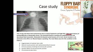 Case 52 floppy baby syndrome approach for floppy infants UMNLLMNL [upl. by Gizela]