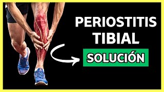 Guía Definitiva para CURAR la PERIOSTITIS TIBIAL Paso a Paso [upl. by Heidy809]