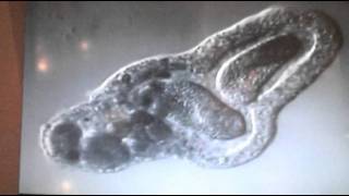 Amoeba eats two paramecia Amoebas lunch [upl. by Lotsyrc]