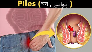 What Happens In Piles Haemorrhoids Bawaseer بواسیر  Symptoms Causes And Treatment UrduHindi [upl. by Lontson959]