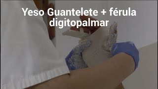 Yeso Guantelete  férula digitopalmar  Fracture amp Plaster [upl. by Adnauqahs81]