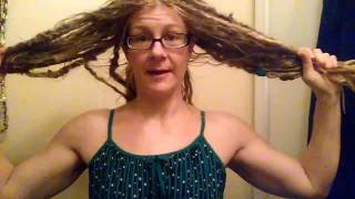 Head lice infestation [upl. by Eydie]