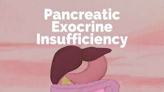 Pancreatic Exocrine Insufficiency  Gastrointestinal Society [upl. by Lavinia398]