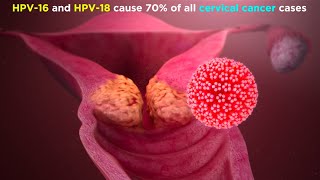 Human Papillomavirus HPV [upl. by Hluchy934]