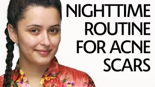 Get Unready With Me Nighttime Routine for Acne Scars  Sephora [upl. by Janifer750]