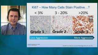 Neuroendocrine Neoplasms Thor Halfdanarson [upl. by Burnett340]