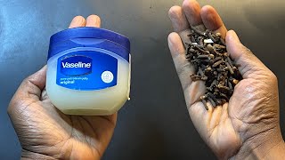 Mix cloves with Vaseline  A secret nobody will never tell you  thank me later [upl. by Notned227]