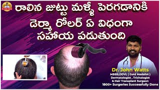 Derma Roller For Hair Growth  డెర్మా రోలర్ ఉపయోగించే విధానం  DrJohn Watts  Trichos [upl. by Ahsiruam]