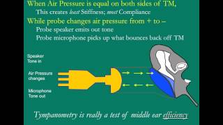 The Tympanogram [upl. by Amzaj]