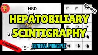 Hebatobiliary Scintigraphy Explained HIDA scan [upl. by Fronnia]