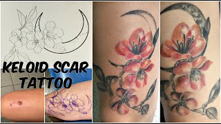 Keloid Scar Tattoo CoverUp Story amp Tips [upl. by Yeliab591]