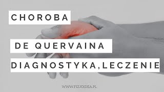 CHOROBA DE QUERVAINA DIAGNOSTYKA LECZENIE  DE QUERVAIN SYNDROME [upl. by Nnaecarg978]