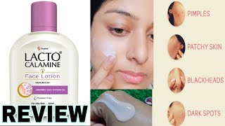 Lacto Calamine face Lotion Review How To Use lacto Calamine Lotion lactocalaminelotion [upl. by Rhtaeh623]