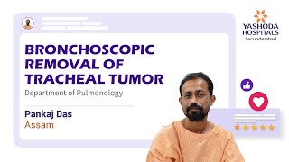 Bronchoscopic Tumor Debulking for Airway Fibroepithelial Polyp  Yashoda Hospitals Hyderabad [upl. by Rammus]