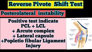 Reverse PivotShift TestPosterolateral Rotatory Instability of the KneeEverything You Need To Know [upl. by Nelyt328]