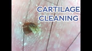 Cartilage Piercing Unclogged Located on an Ear Read Details [upl. by Emmerie629]