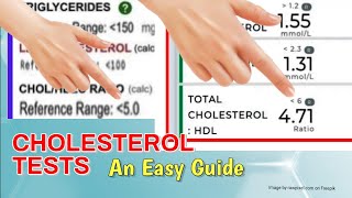 Cholesterol Tests Easy Guide [upl. by Anolahs]