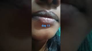 derma co kojic acid lip balm review lip lightening lip balm day 11 lipbalm [upl. by Mrots685]