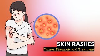 Skin Rash Causes Signs and Symptoms Diagnosis and Treatment [upl. by Emmi]